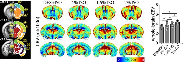 4가지 마취 조건에서 뇌 혈류지표를 측정·계산해 쥐 MRI 뇌 영상에 맵핑한 영상과 수치 결과. (사진=IBS)